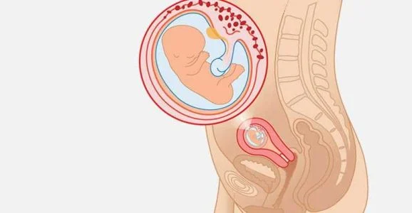 جنین جنین سه ماهه در کجای شکم قرار دارد؟