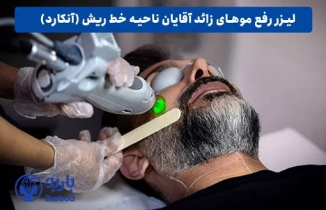 لیزر موهای زائد آقایان در تهران: راهنمای کامل برای پوست و موی مردانه