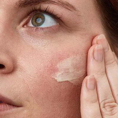  حساسیت پوستی و آلرژی به مواد شیمیایی؛ درمان و مراقبت