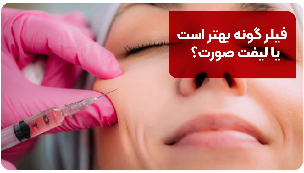 فیلر گونه بهتر است یا لیفت صورت؟