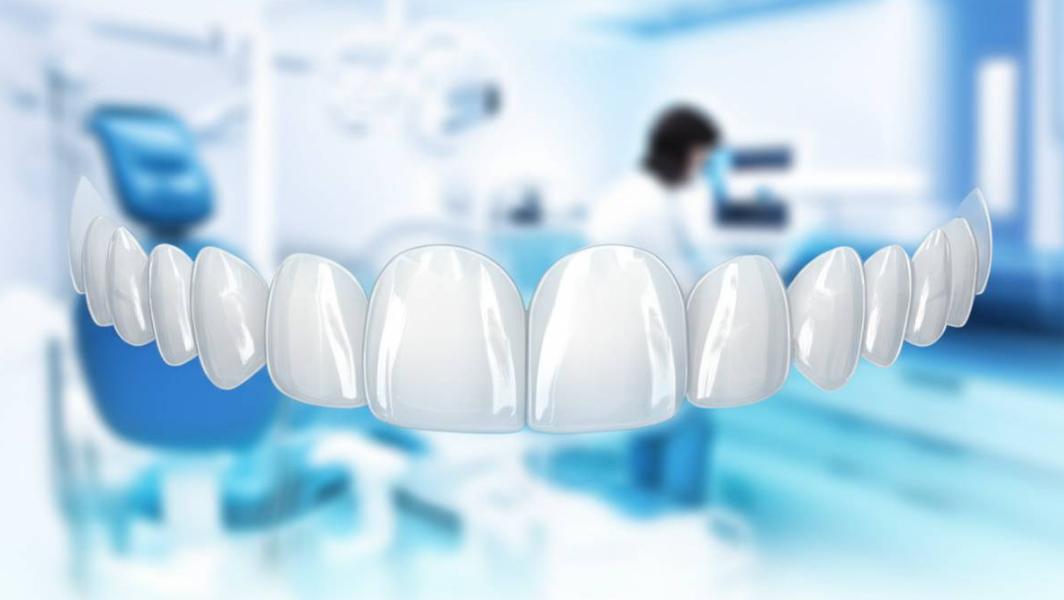 آیا لمینت دندان شیشه ای واقعیت دارید؟ چه کسانی کاندید این نوع لمینت هستند؟
