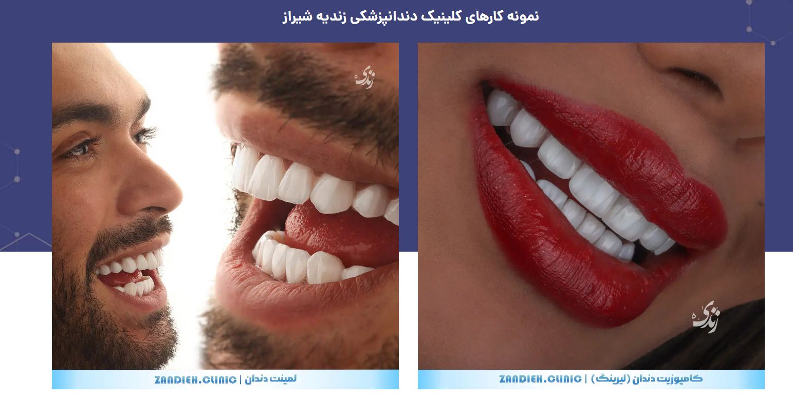 نمونه کارهای کلینیک دندانپزشکی زندیه شیراز