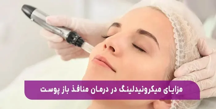 میکرونیدلینگ، روشی موثر برای درمان منافذ باز پوست