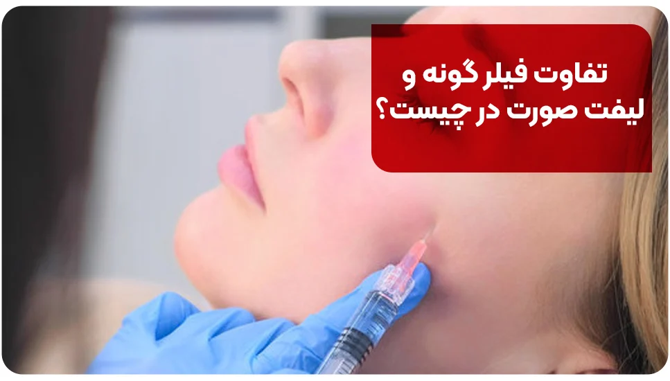 تفاوت فیلر گونه و لیفت صورت در چیست؟