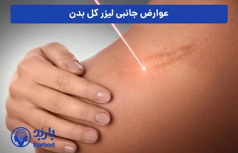 قیمت لیزر فول بادی در تهران: کیفیت بالا با هزینه مناسب