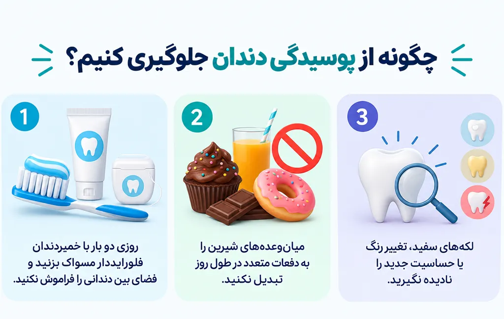 چگونه از پوسیدگی دندان جلوگیری کنیم؟