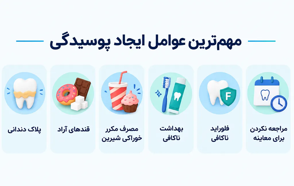 مهم ترین عوامل ایجاد پوسیدگی